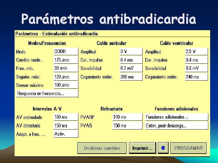 Parámetros antibradicardia 