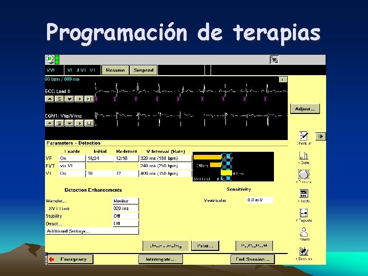 Programación de terapias 