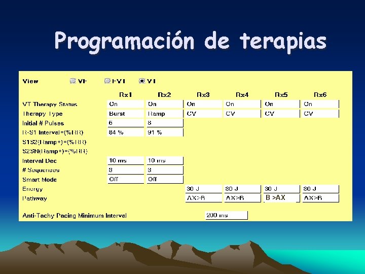 Programación de terapias B >AX 