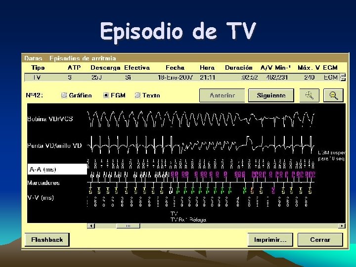 Episodio de TV 