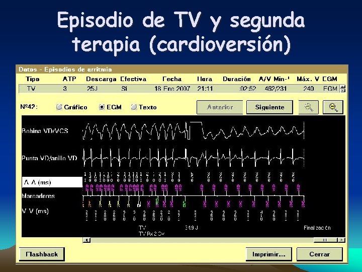 Episodio de TV y segunda terapia (cardioversión) 