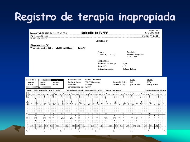 Registro de terapia inapropiada 