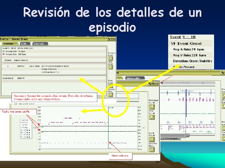 Revisión de los detalles de un episodio 