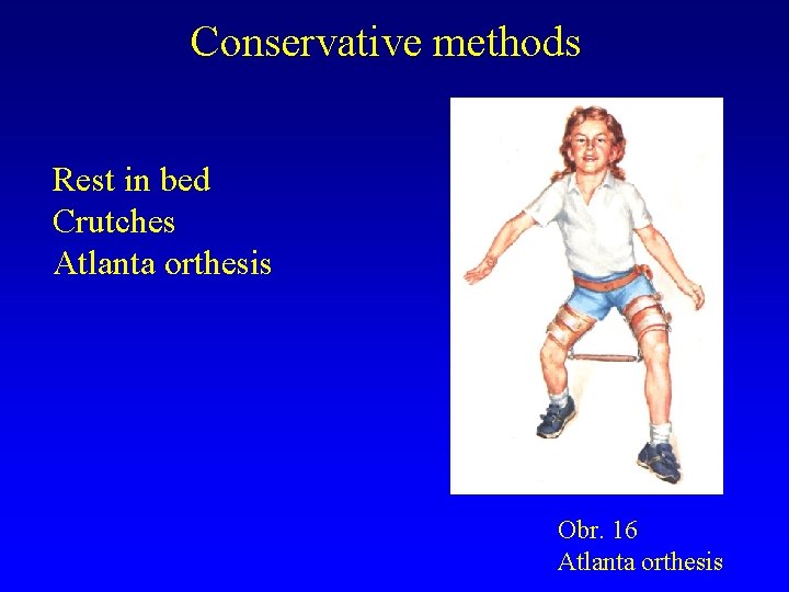 Conservative methods Rest in bed Crutches Atlanta orthesis Obr. 16 Atlanta orthesis 