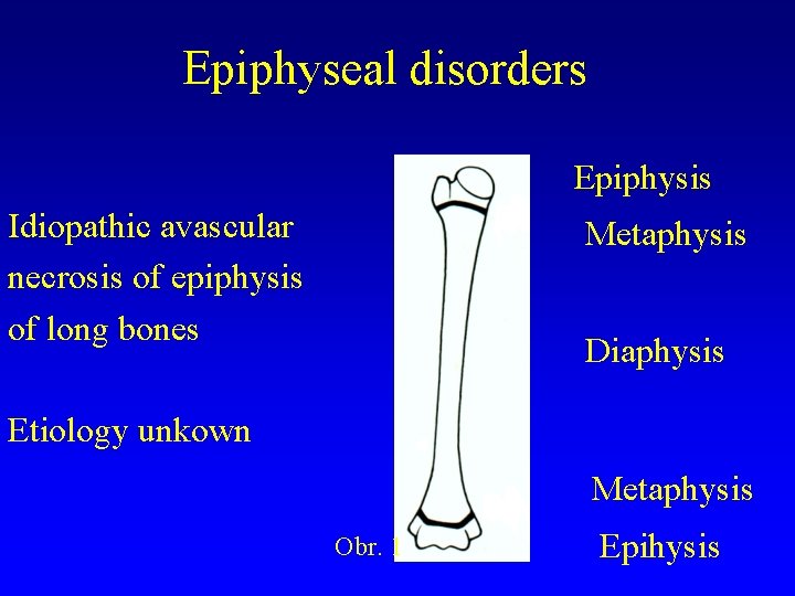 Epiphyseal disorders Epiphysis Idiopathic avascular necrosis of epiphysis of long bones Metaphysis Diaphysis Etiology