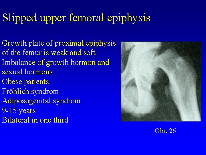 Slipped upper femoral epiphysis Growth plate of proximal epiphysis of the femur is weak