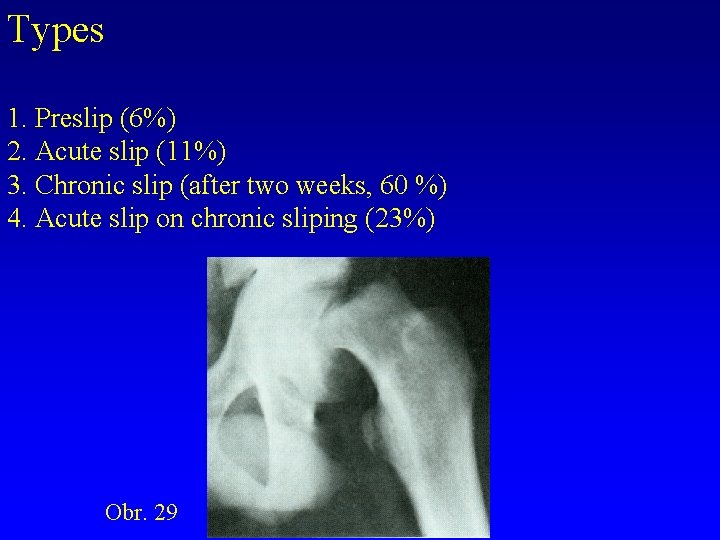 Types 1. Preslip (6%) 2. Acute slip (11%) 3. Chronic slip (after two weeks,