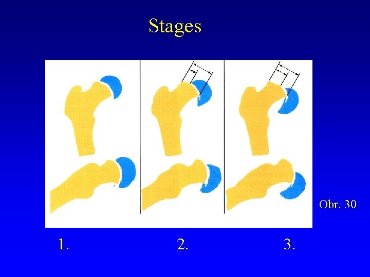 Stages Obr. 30 1. 2. 3. Stages Obr. 30 1. 2. 3.