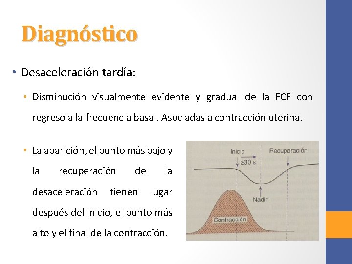 Diagnóstico • Desaceleración tardía: • Disminución visualmente evidente y gradual de la FCF con