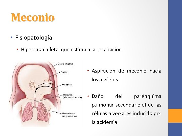 Meconio • Fisiopatología: • Hipercapnia fetal que estimula la respiración. • Aspiración de meconio