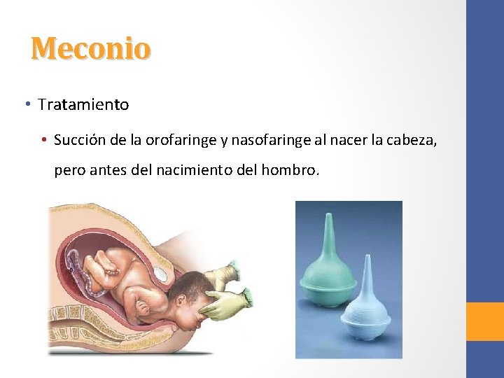 Meconio • Tratamiento • Succión de la orofaringe y nasofaringe al nacer la cabeza,