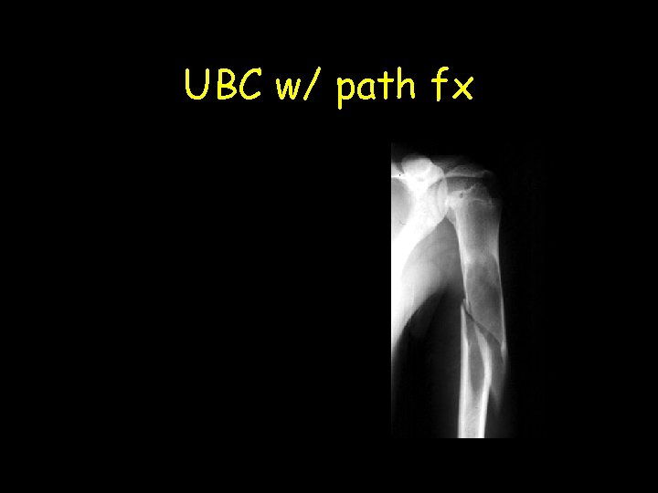 UBC w/ path fx 