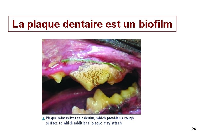 La plaque dentaire est un biofilm PL Toutain Ecole Vétérinaire Toulouse 24 