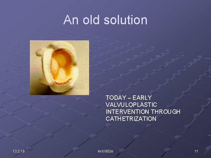 An old solution TODAY – EARLY VALVULOPLASTIC INTERVENTION THROUGH CATHETRIZATION 13. 2. 18 kvs