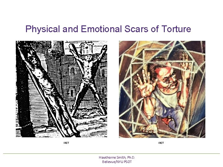 Physical and Emotional Scars of Torture IRCT Hawthorne Smith, Ph. D. Bellevue/NYU PSOT Physical and Emotional Scars of Torture IRCT Hawthorne Smith, Ph. D. Bellevue/NYU PSOT