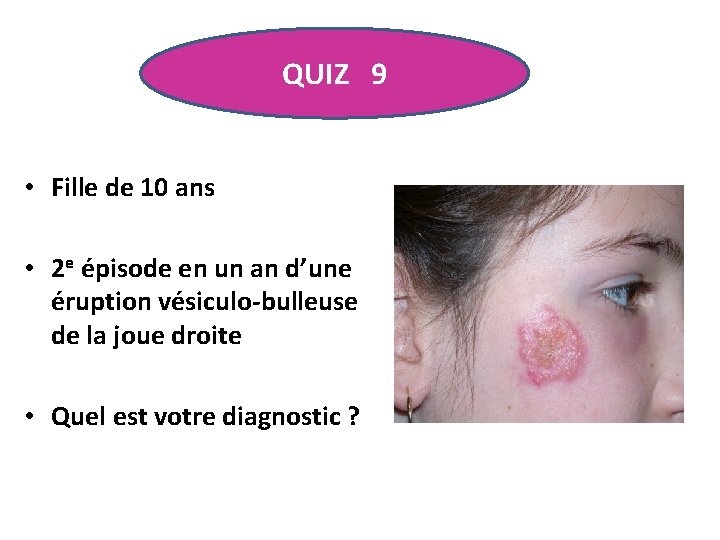 QUIZ 9 • Fille de 10 ans • 2 e épisode en un an