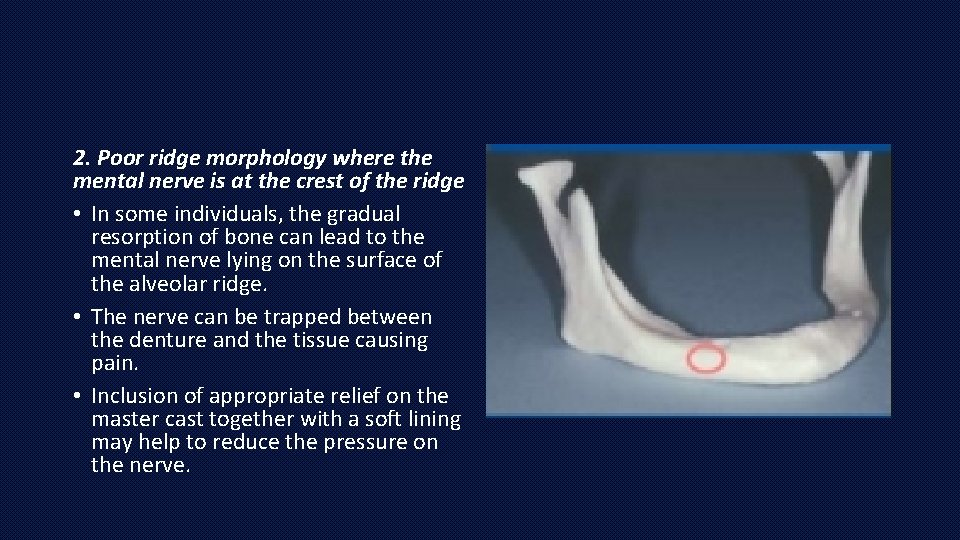 2. Poor ridge morphology where the mental nerve is at the crest of the