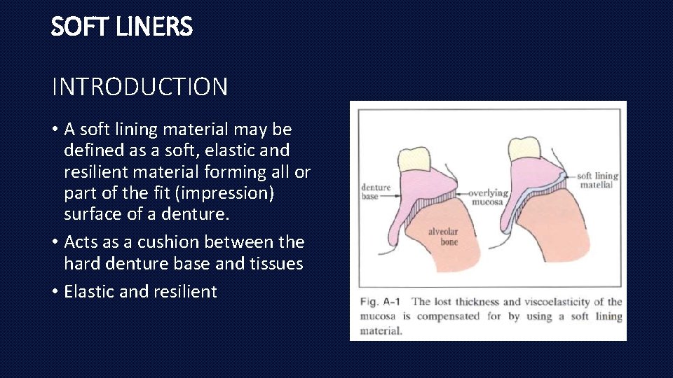 SOFT LINERS INTRODUCTION • A soft lining material may be defined as a soft,