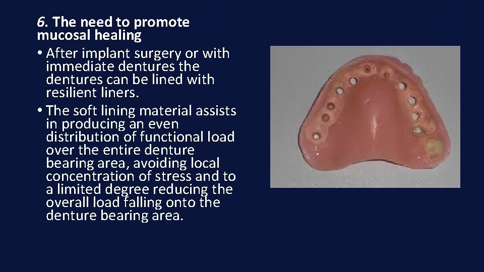 6. The need to promote mucosal healing • After implant surgery or with immediate