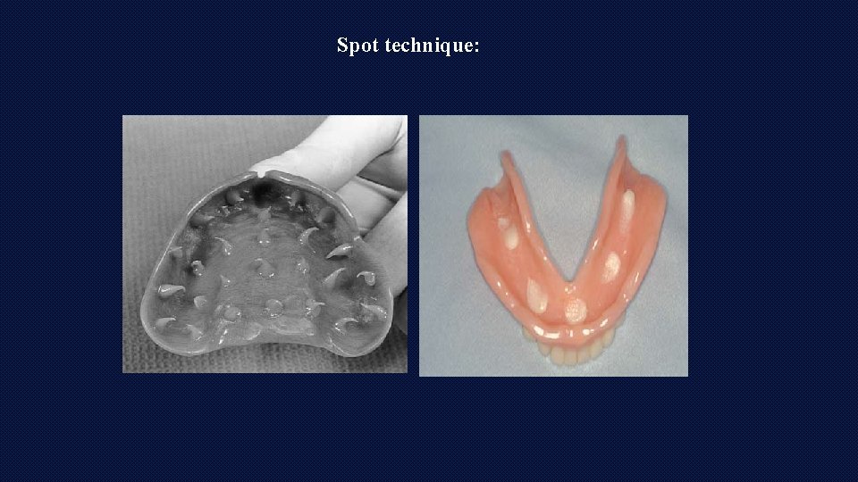 Spot technique: 