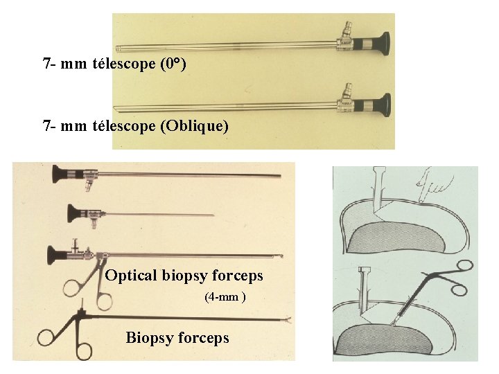 7 - mm télescope (0°) 7 - mm télescope (Oblique) Optical biopsy forceps (4