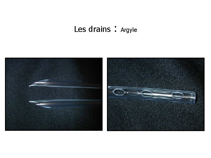 Les drains : Argyle 
