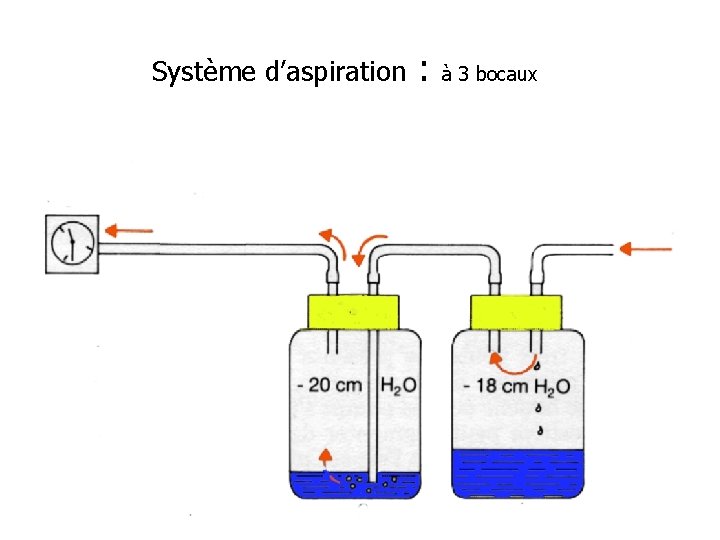 Système d’aspiration Aspiration : à 3 bocaux Air Patient 20 cm 2 cm Contrôle