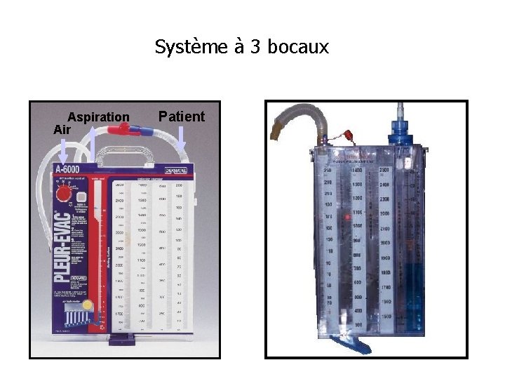 Système à 3 bocaux Aspiration Air 3 2 Patient 1 