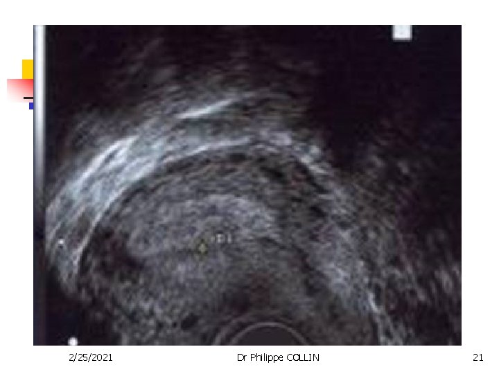 2/25/2021 Dr Philippe COLLIN 21 