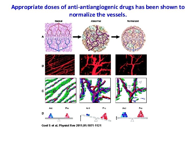 Appropriate doses of anti-antiangiogenic drugs has been shown to normalize the vessels. Goel S Appropriate doses of anti-antiangiogenic drugs has been shown to normalize the vessels. Goel S