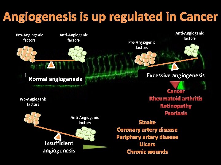 Angiogenesis is up regulated in Cancer Pro-Angiogenic factors Anti-Angiogenic factors Normal angiogenesis Pro-Angiogenic factors Angiogenesis is up regulated in Cancer Pro-Angiogenic factors Anti-Angiogenic factors Normal angiogenesis Pro-Angiogenic factors