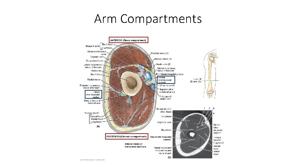 Arm Compartments 