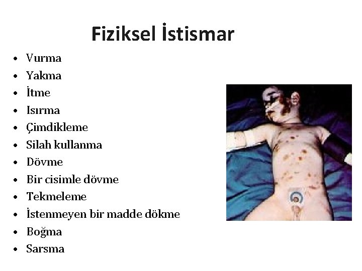 Fiziksel İstismar • • • Vurma Yakma İtme Isırma Çimdikleme Silah kullanma Dövme Bir