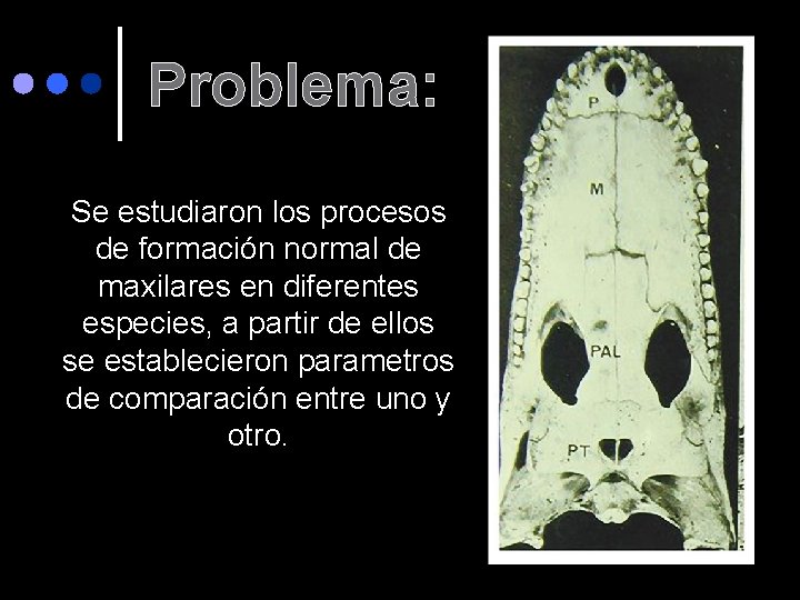 Problema: Se estudiaron los procesos de formación normal de maxilares en diferentes especies, a