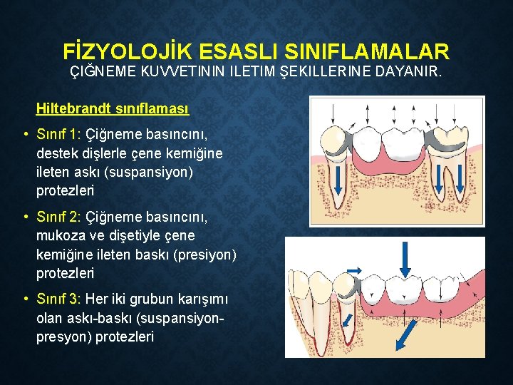 FİZYOLOJİK ESASLI SINIFLAMALAR ÇIĞNEME KUVVETININ ILETIM ŞEKILLERINE DAYANIR. Hiltebrandt sınıflaması • Sınıf 1: Çiğneme