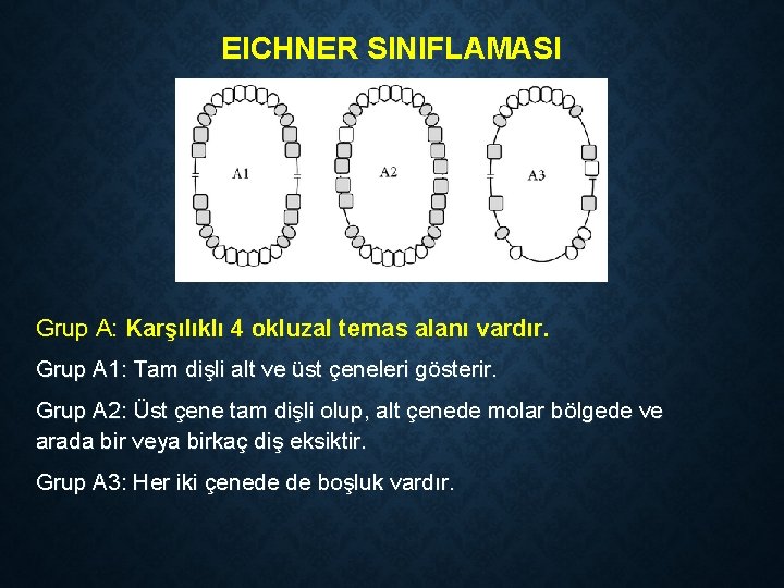 EICHNER SINIFLAMASI Grup A: Karşılıklı 4 okluzal temas alanı vardır. Grup A 1: Tam