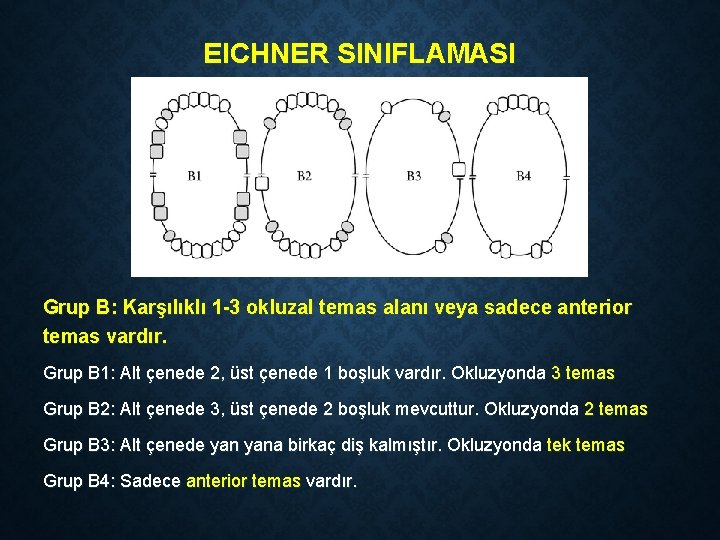 EICHNER SINIFLAMASI Grup B: Karşılıklı 1 -3 okluzal temas alanı veya sadece anterior temas