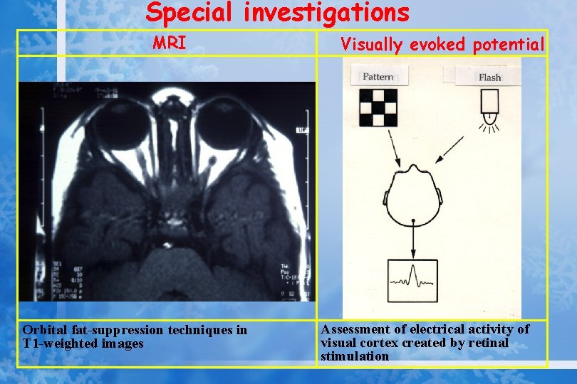 Special investigations MRI Orbital fat-suppression techniques in T 1 -weighted images Visually evoked potential