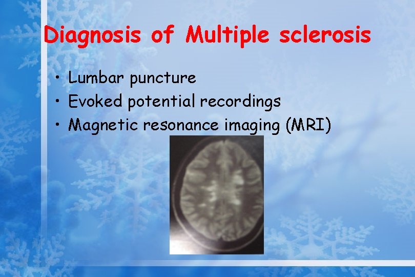 Diagnosis of Multiple sclerosis • Lumbar puncture • Evoked potential recordings • Magnetic resonance