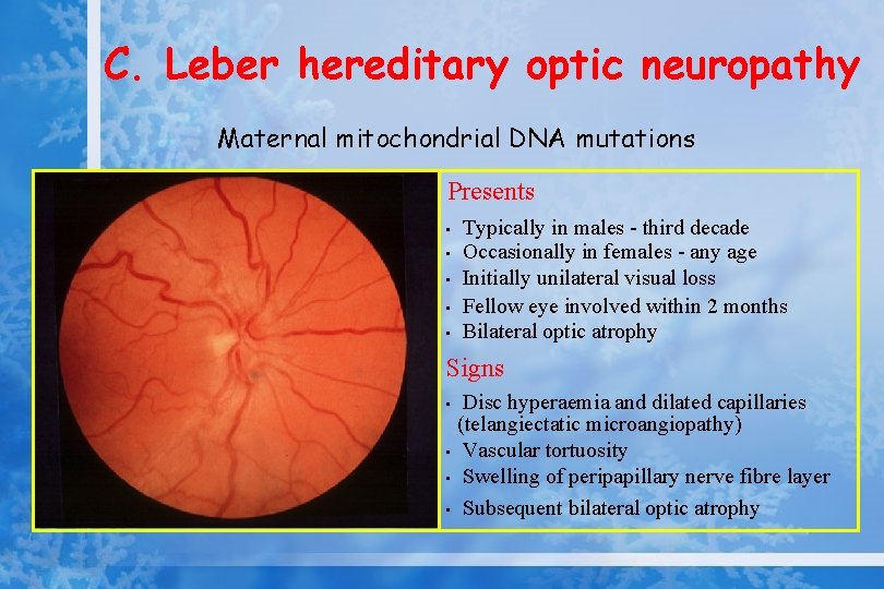 C. Leber hereditary optic neuropathy Maternal mitochondrial DNA mutations Presents • • • Typically