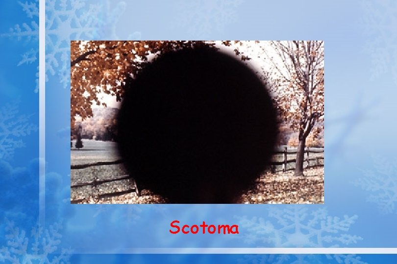 Scotoma 