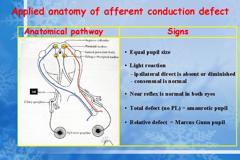 Applied anatomy of afferent conduction defect Anatomical pathway Signs • Equal pupil size •