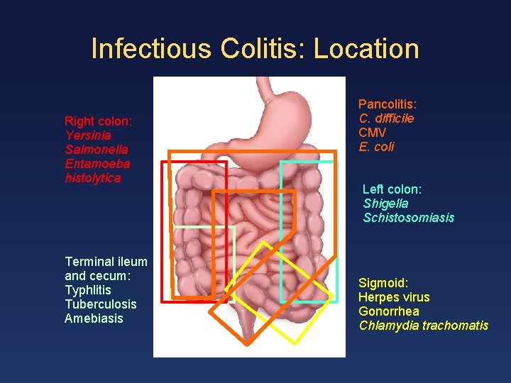 Infectious Colitis: Location Right colon: Yersinia Salmonella Entamoeba histolytica Terminal ileum and cecum: Typhlitis