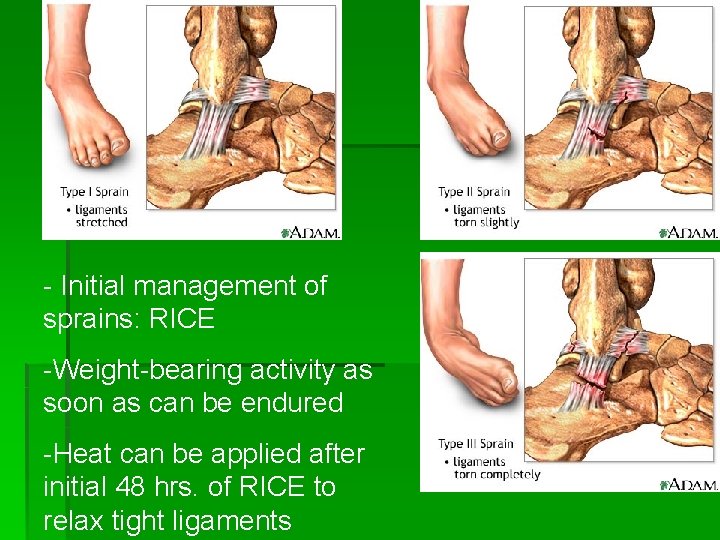 - Initial management of sprains: RICE -Weight-bearing activity as soon as can be endured