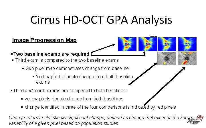 Cirrus HD‐OCT GPA Analysis Image Progression Map Baseline §Two baseline exams are required §