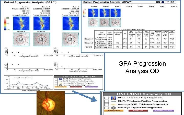 GPA Progression Analysis OD 