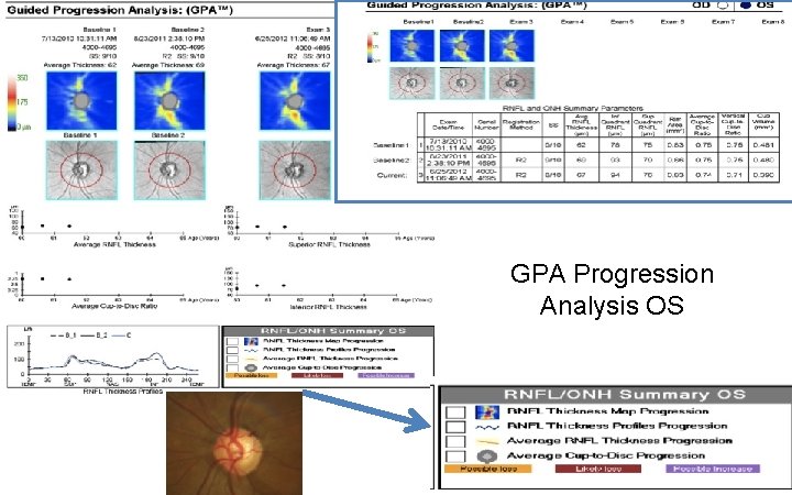 GPA Progression Analysis OS 