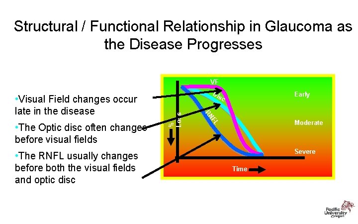 Structural / Functional Relationship in Glaucoma as the Disease Progresses VF • The RNFL