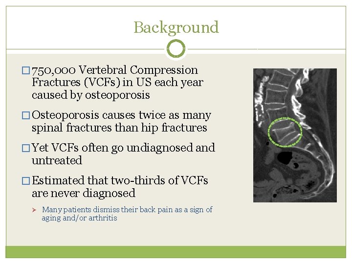 Background � 750, 000 Vertebral Compression Fractures (VCFs) in US each year caused by