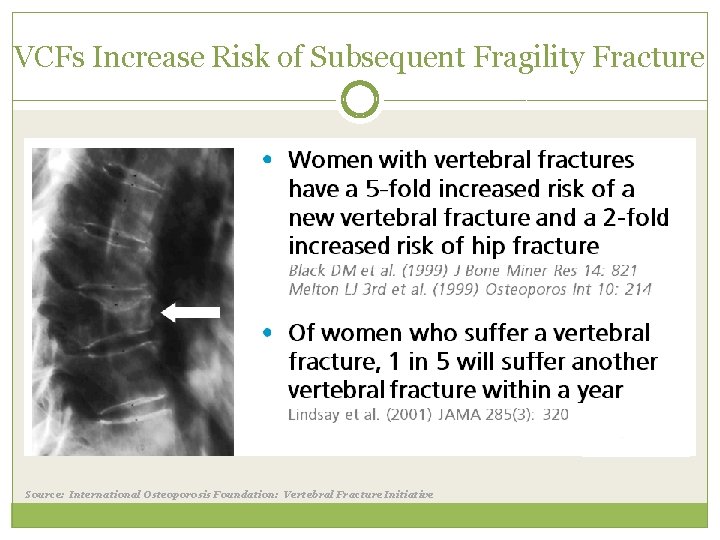 VCFs Increase Risk of Subsequent Fragility Fracture Source: International Osteoporosis Foundation: Vertebral Fracture Initiative